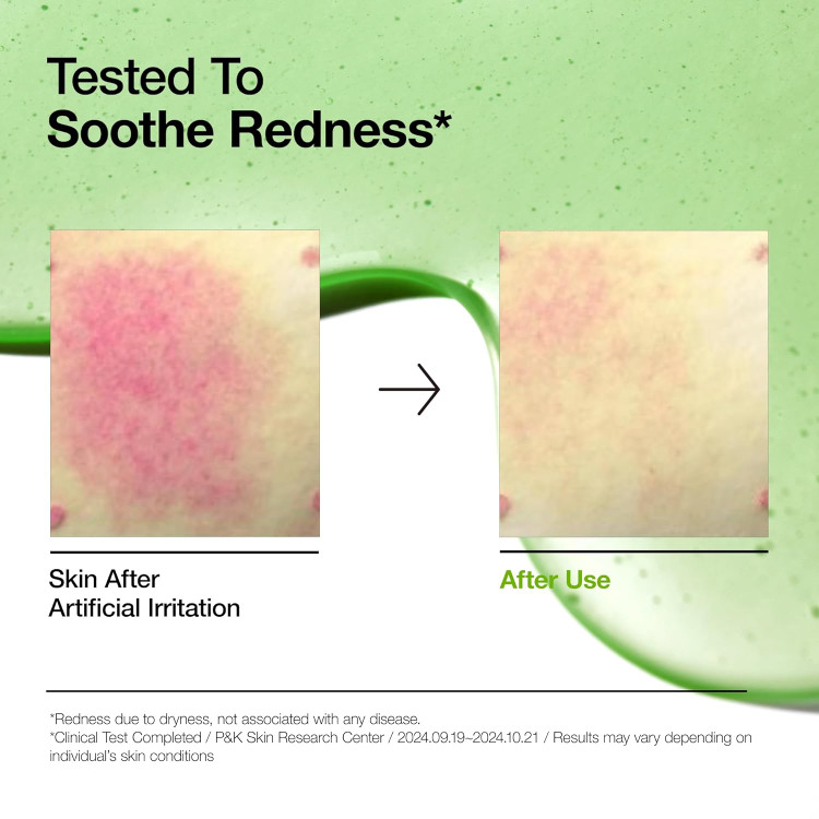 سرم آزلائیک اسید 10% و هیالورون آنوا Anua Azelaic Acid 10 Hyaluron Redness Soothing Serum